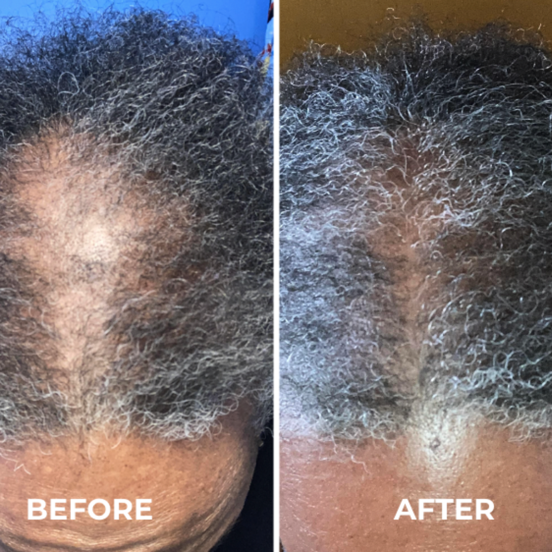 Blufera – Scalp Serum 39